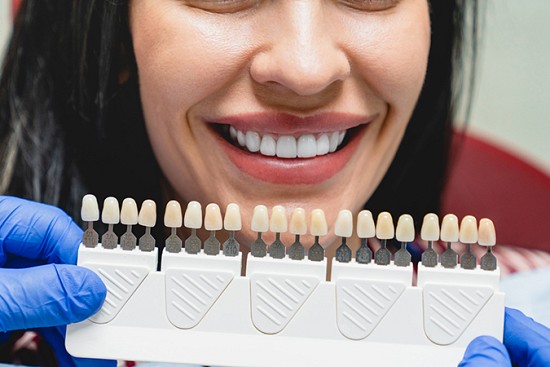 Transform Your Smile With Porcelain Veneers image