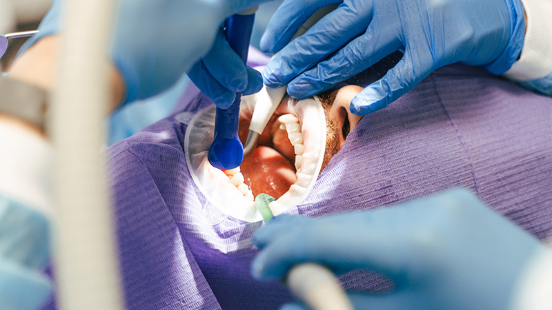 Cavities: The Most Common Dental Health Concern