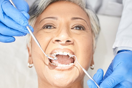 Dental Care For Seniors: Caring For Your Teeth Over 55