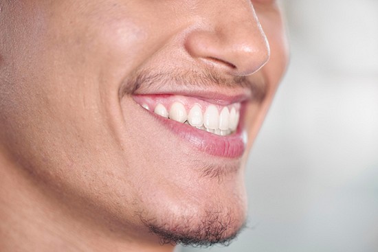 Replacing Missing Teeth