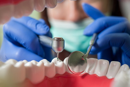 Are Dental Implants Right For You?