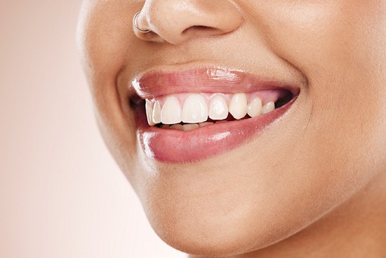 In-Office vs. Take-Home Teeth Whitening